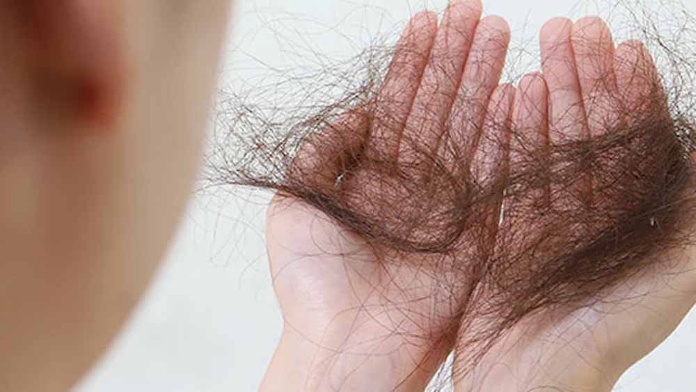 हेयर वॉश के बाद हेयर फॉल की समस्या? अपनाएं ये सिंपल टिप्स और पाएं रेशमी-मजबूत बाल