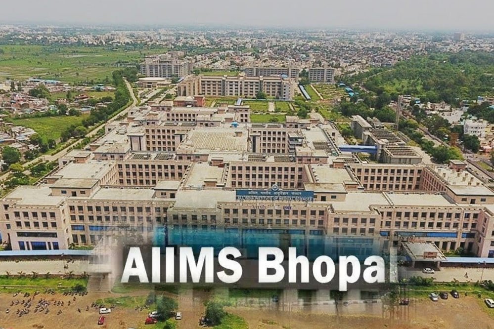 मेडिकल ब्रिलियंस! एम्स भोपाल ने मरीज के लिए अंजाम दी दुर्लभ और जटिल ‘होल लंग्स लैवेज’ सर्जरी