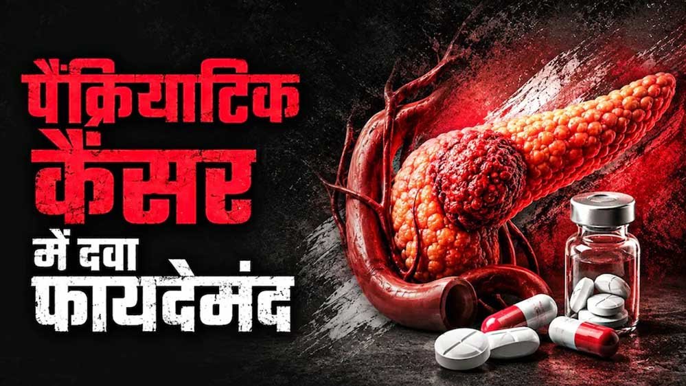 पैंक्रियाटिक कैंसर के इलाज में नई उम्मीद, ‘रासोंक’ दवा से घटा मौत का जोखिम; FDA ने दी मंजूरी