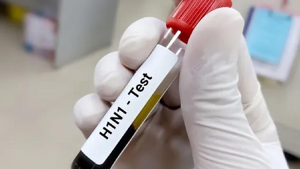 स्वाइन फ्लू से हिसार में तीसरी महिला की मौत, स्वास्थ्य विभाग कर रहा रिपोर्ट का ऑडिट