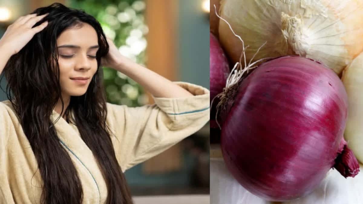 बारिश में तेजी से झड़ रहे बाल? प्याज के रस की ये ट्रिक करें, जड़ों से मजबूत होंगे बाल