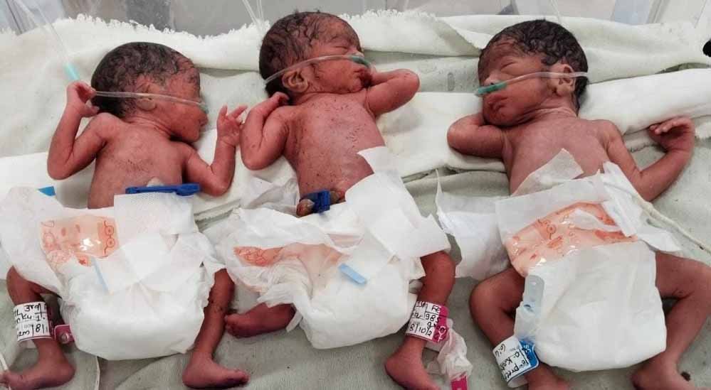 शहडोल में खुशियों की तिहरी सौगात, 20 वर्षीय महिला ने तीन बच्चों को दिया जन्म; जच्चा-बच्चा स्वस्थ